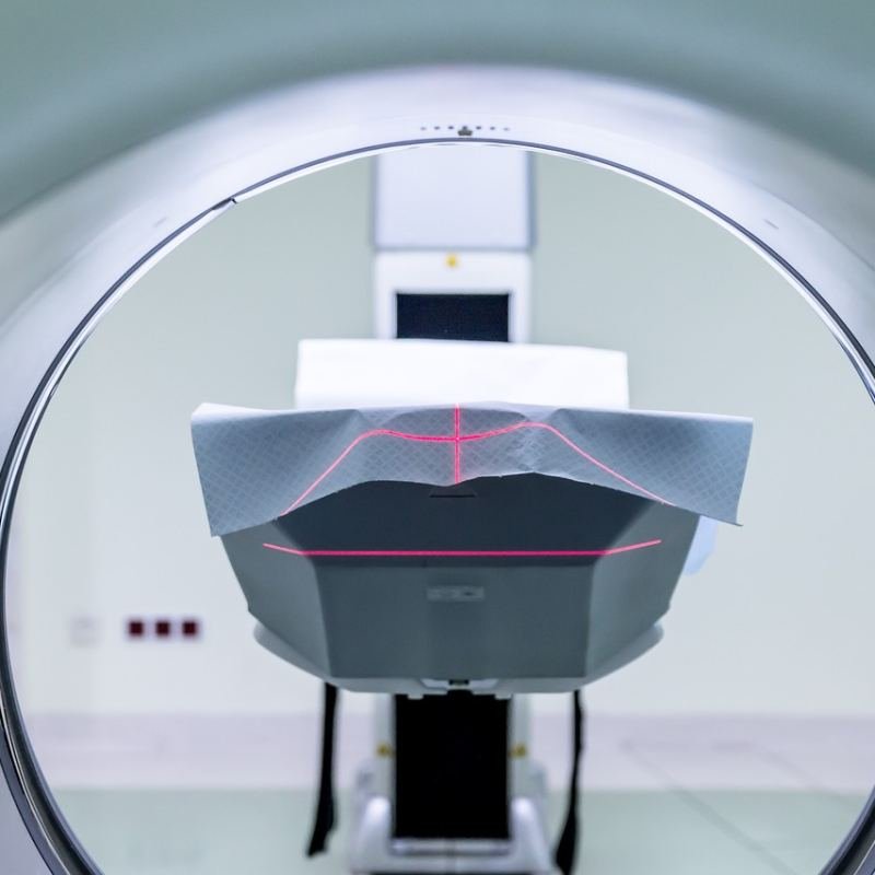 رنين مغناطيسي MRI
